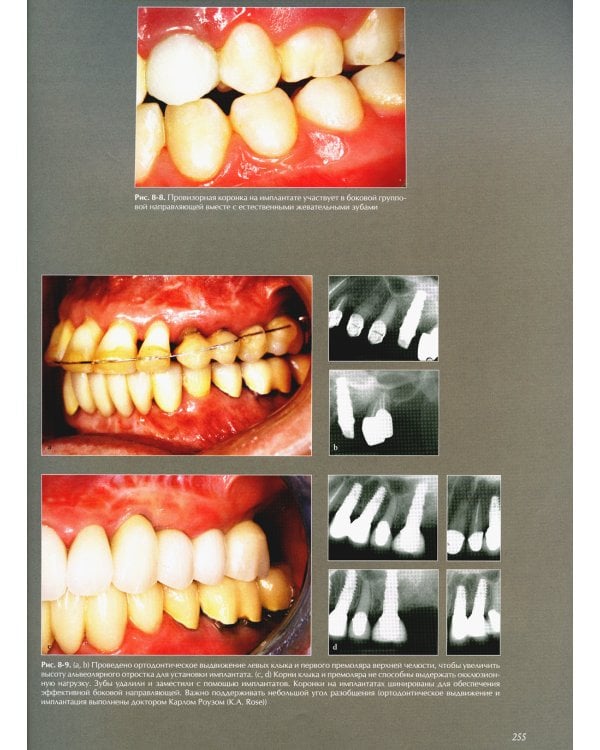 Междисциплинарное планирование стоматологического лечения. Принципы, цели, практическое применение. Иллюстрированные лекции