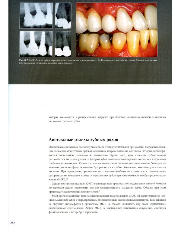 Междисциплинарное планирование стоматологического лечения. Принципы, цели, практическое применение. Иллюстрированные лекции