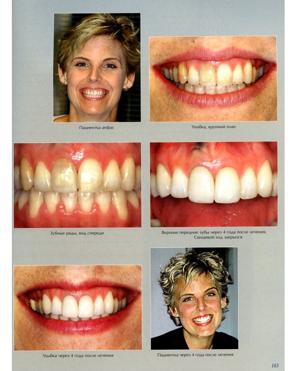 Междисциплинарное планирование стоматологического лечения. Принципы, цели, практическое применение. Иллюстрированные лекции