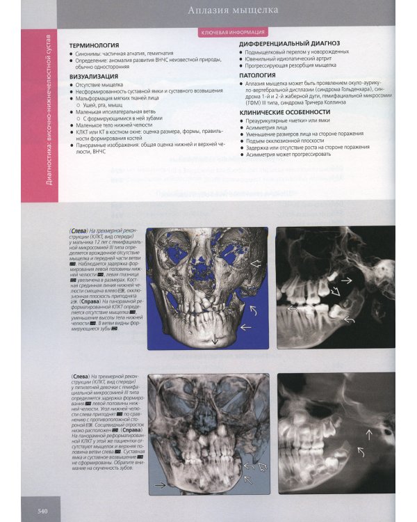 Лучевая диагностика. Полость рта и челюстно-лицевая область. В 2 т (комплект из 2-х книг)