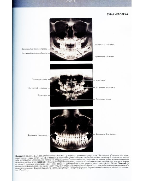 Лучевая диагностика. Полость рта и челюстно-лицевая область. В 2 т (комплект из 2-х книг)