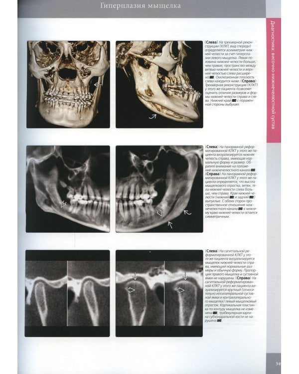 Лучевая диагностика. Полость рта и челюстно-лицевая область. В 2 т (комплект из 2-х книг)