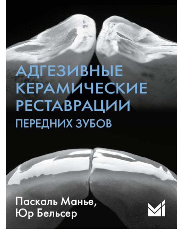 Адгезивные керамические реставрации передних зубов. 4-е изд