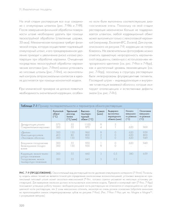 Адгезивные керамические реставрации передних зубов. 4-е изд