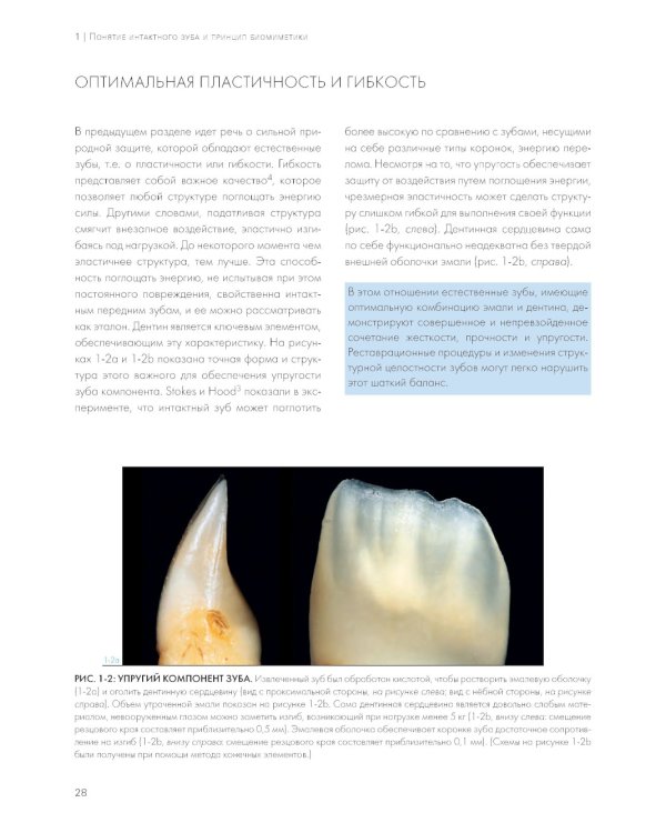 Адгезивные керамические реставрации передних зубов. 4-е изд