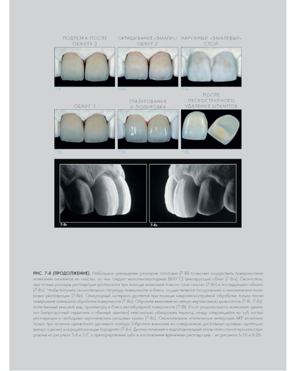 Адгезивные керамические реставрации передних зубов. 4-е изд