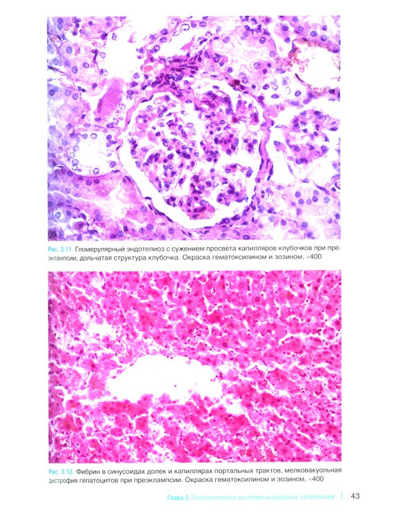 Патологическая анатомия акушерских заболеваний