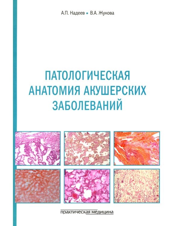 Патологическая анатомия акушерских заболеваний
