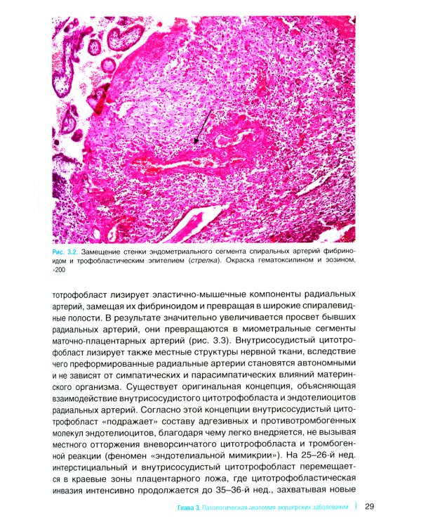 Патологическая анатомия акушерских заболеваний