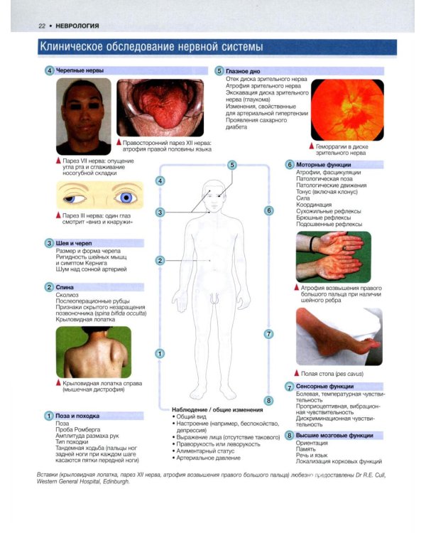 Внутренние болезни по Дэвидсону. В 5 т. Т. 4. Неврология. Психиатрия. Офтальмология. Инсульт. 2-е изд