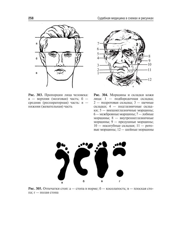 Судебная медицина в схемах и рисунках: Учебное пособие