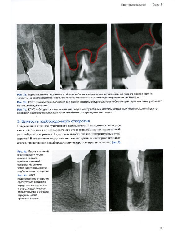 Микрохирургическая эндодонтия