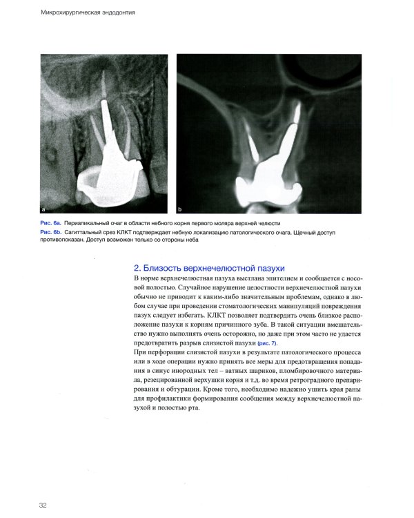 Микрохирургическая эндодонтия