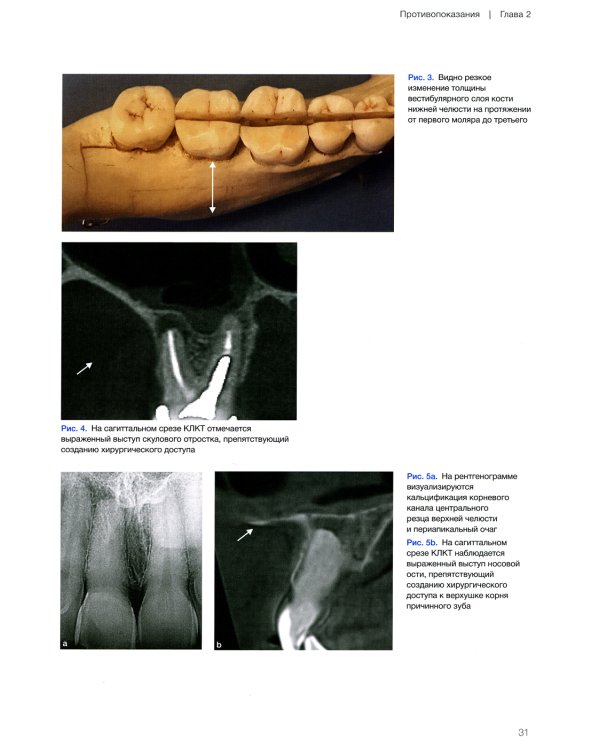 Микрохирургическая эндодонтия