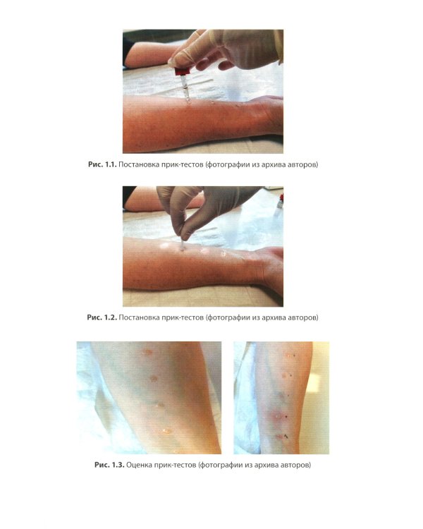 Клиническая аллергология. Руководство для практикующих врачей