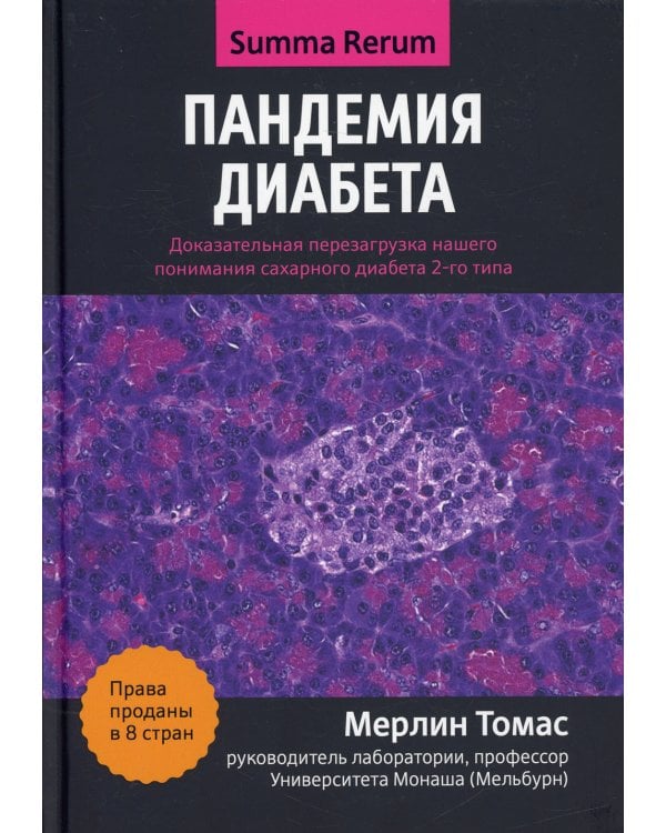 Пандемия диабета: доказательная перезагрузка нашего понимания сахарного диабета 2-го типа