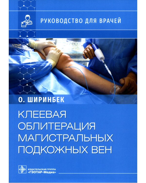 Клеевая облитерация магистральных подкожных вен: руководство для врачей