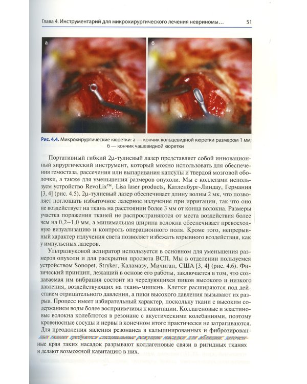Достижения в области микронейрохирургии вестибулярной шванномы. Улучшение результатов с помощью инновационных технологий