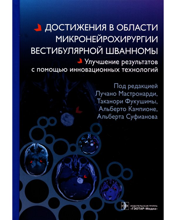 Достижения в области микронейрохирургии вестибулярной шванномы. Улучшение результатов с помощью инновационных технологий
