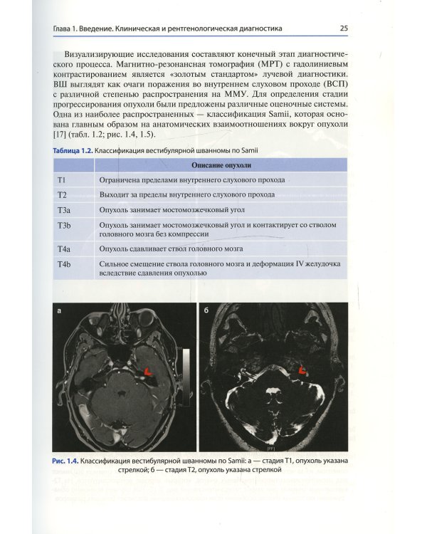 Достижения в области микронейрохирургии вестибулярной шванномы. Улучшение результатов с помощью инновационных технологий