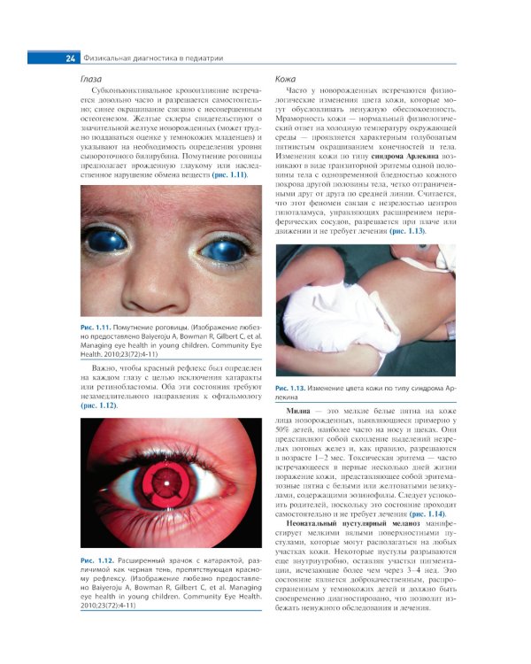 Физикальная диагностика в педиатрии по Хатчисону : иллюстрированное руководство