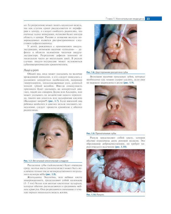 Физикальная диагностика в педиатрии по Хатчисону : иллюстрированное руководство