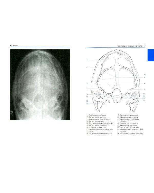 Карманный атлас рентгенологической анатомии. 8-е изд