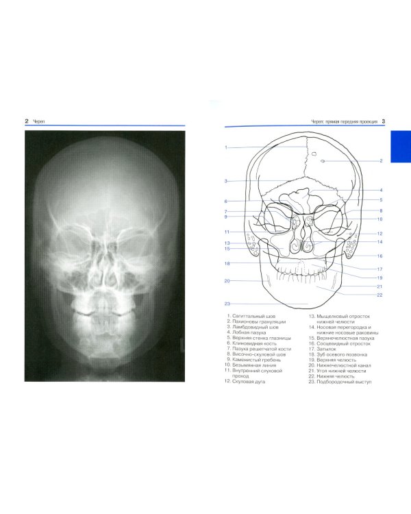 Карманный атлас рентгенологической анатомии. 8-е изд