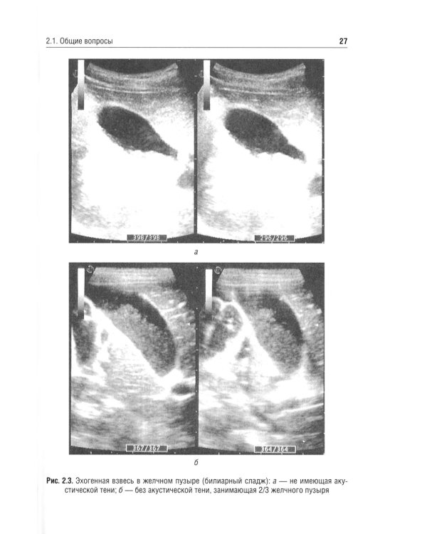 Заболевания желчевыводящих путей у детей: Учебное пособие