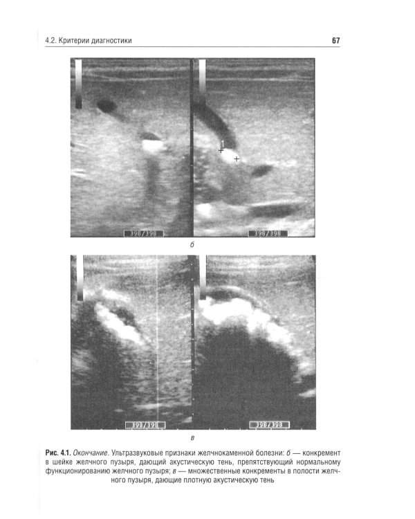 Заболевания желчевыводящих путей у детей: Учебное пособие