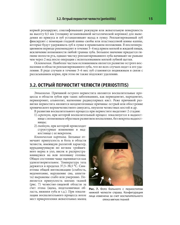 Абсцессы и флегмоны челюстно-лицевой области и шеи. Атлас: учебное пособие
