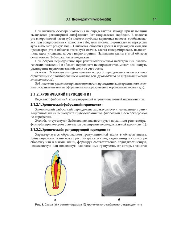 Абсцессы и флегмоны челюстно-лицевой области и шеи. Атлас: учебное пособие