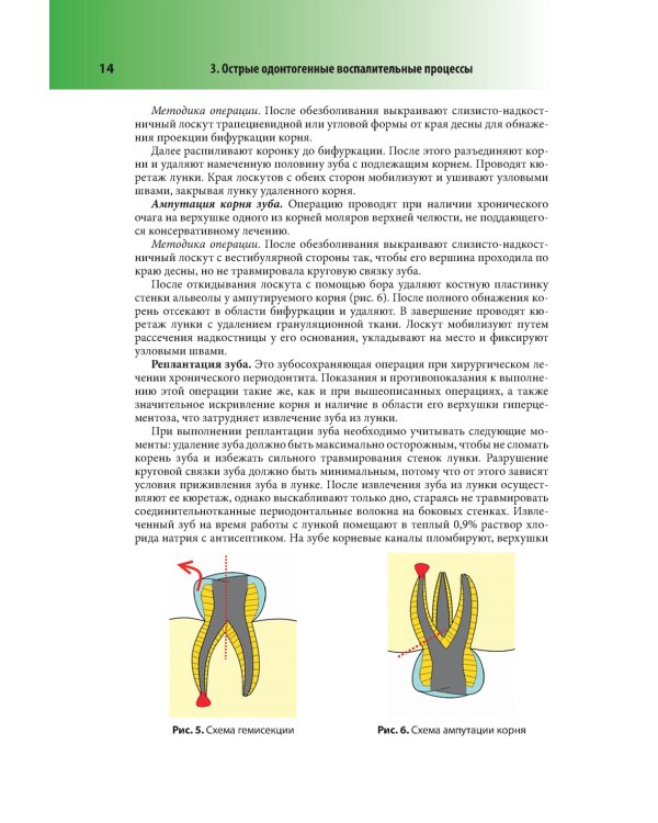 Абсцессы и флегмоны челюстно-лицевой области и шеи. Атлас: учебное пособие