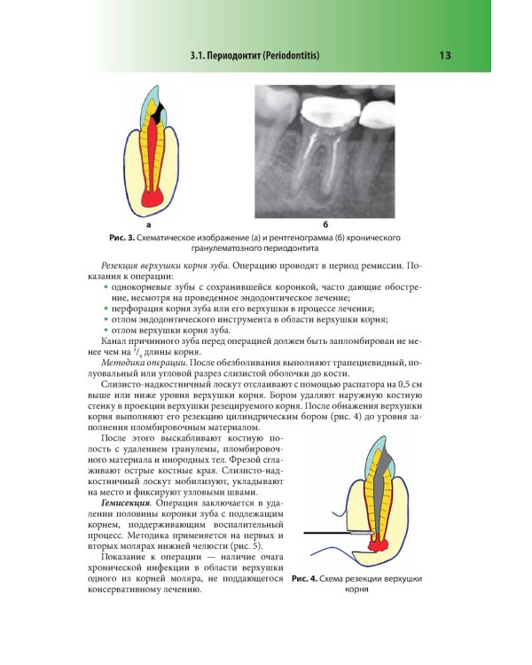 Абсцессы и флегмоны челюстно-лицевой области и шеи. Атлас: учебное пособие