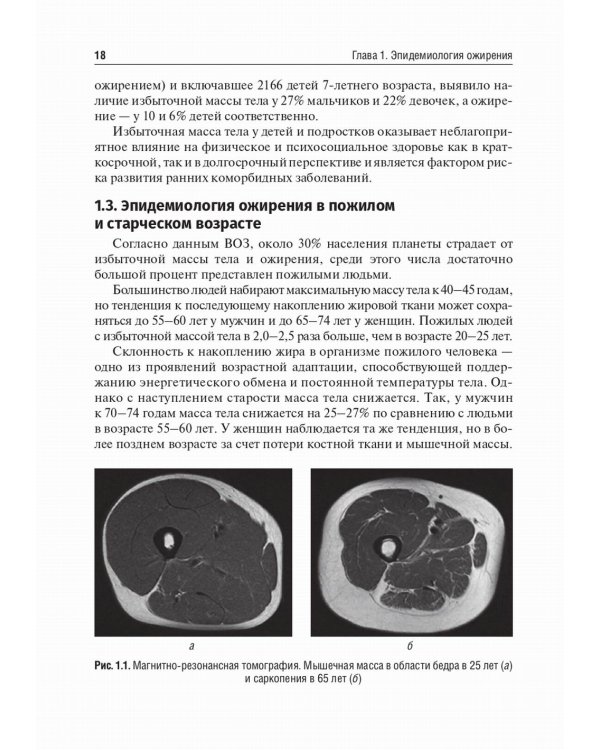 Медицинская реабилитация при ожирении: Учебное пособие