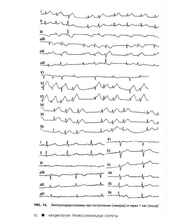 ЭхоКГ понятным языком; Кардиология: профессиональные секреты (комплект из 2-х книг)