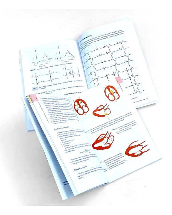 ЭхоКГ понятным языком; Кардиология: профессиональные секреты (комплект из 2-х книг)