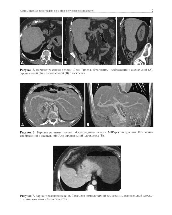 Компьютерная томография печени и желчевыводящих путей: практическое руководство