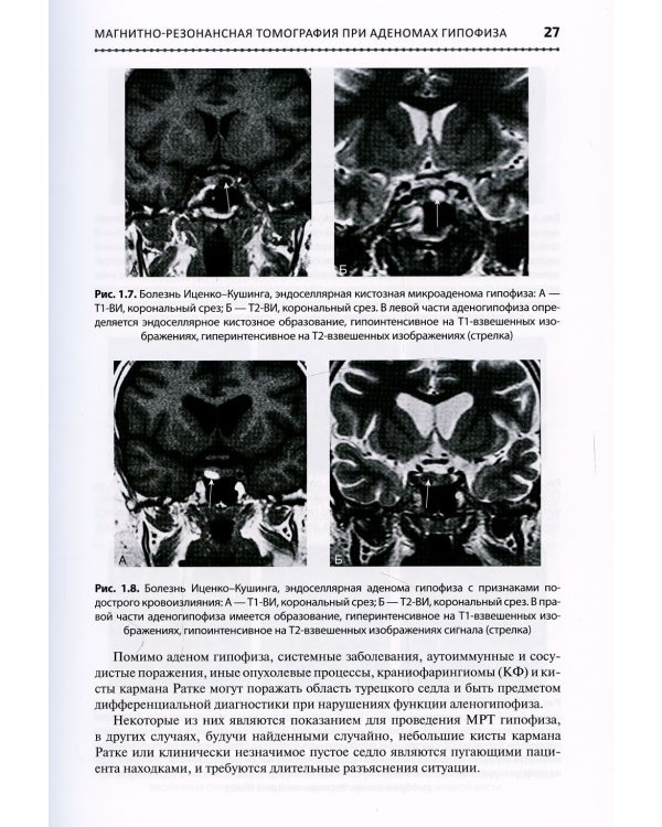 Основы клинической нейроэндокринологии