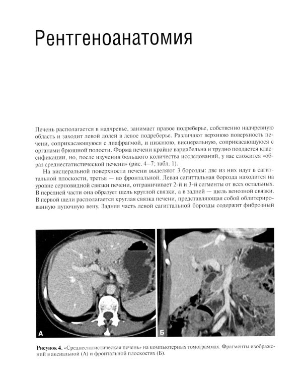 Компьютерная томография печени и желчевыводящих путей: практическое руководство