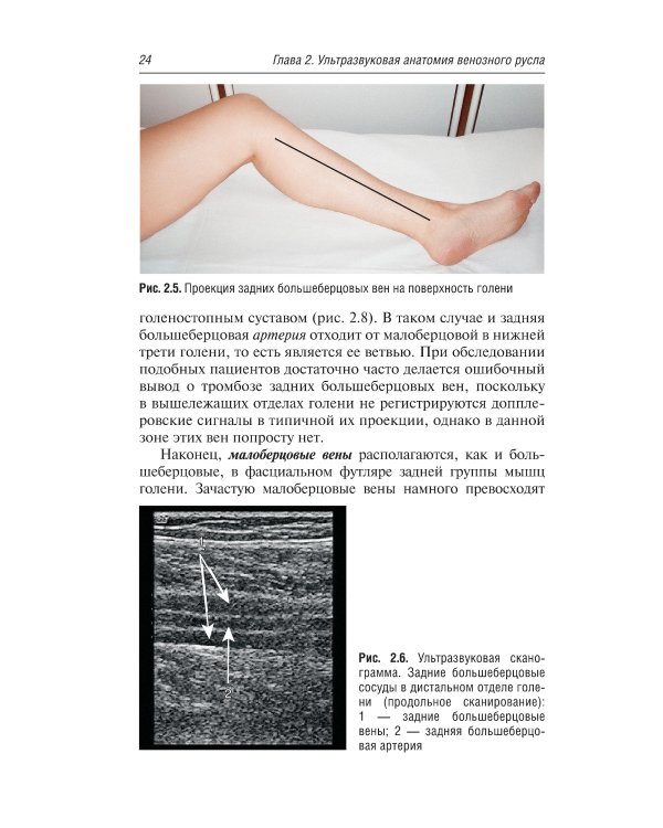 Ультразвуковая диагностика болезней вен. 3-е изд., испр.и доп