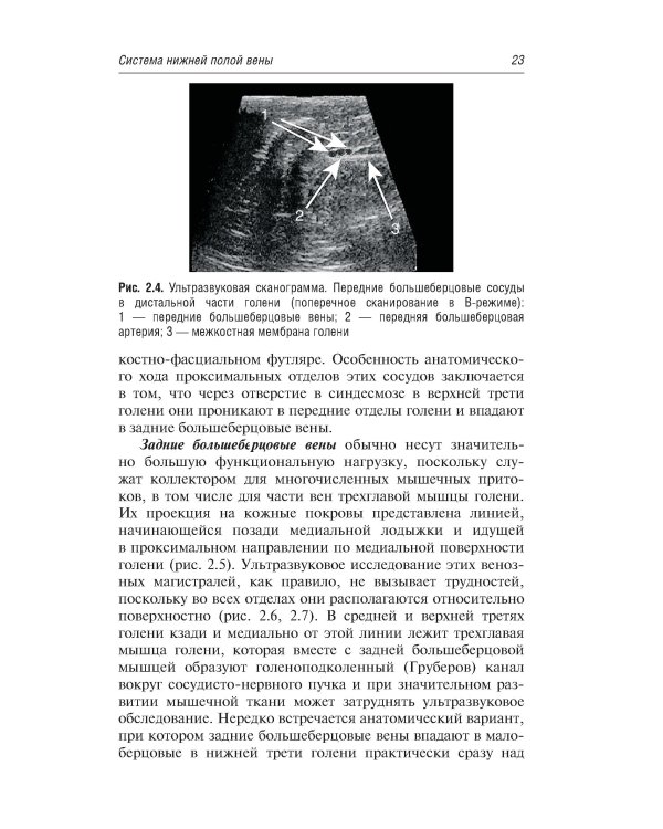 Ультразвуковая диагностика болезней вен. 3-е изд., испр.и доп