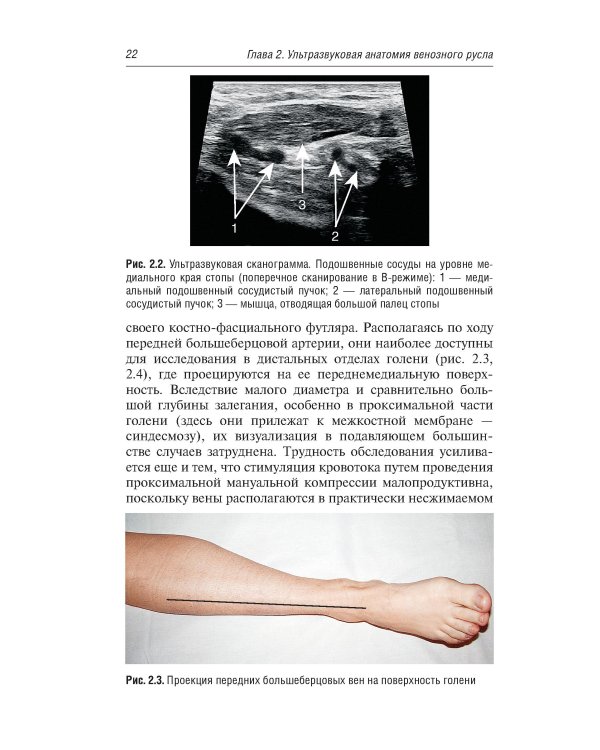Ультразвуковая диагностика болезней вен. 3-е изд., испр.и доп