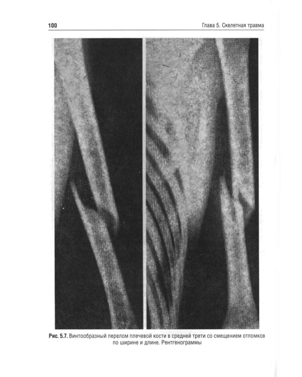 Детская травматология: Учебник