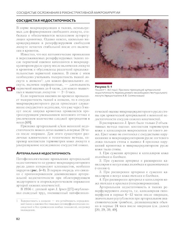 Сосудистые осложнения в реконструктивной микрохирургии