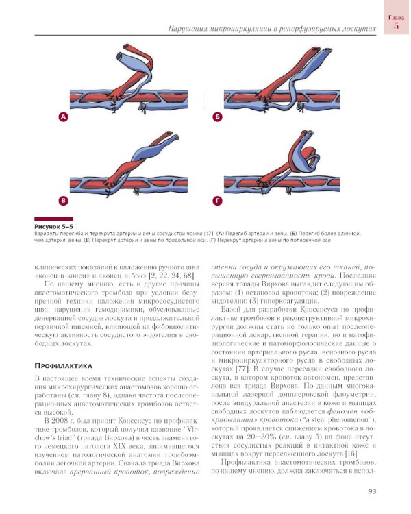 Сосудистые осложнения в реконструктивной микрохирургии