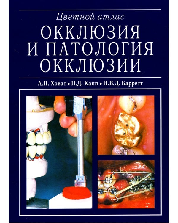 Окклюзия и патология окклюзии. Цветной атлас