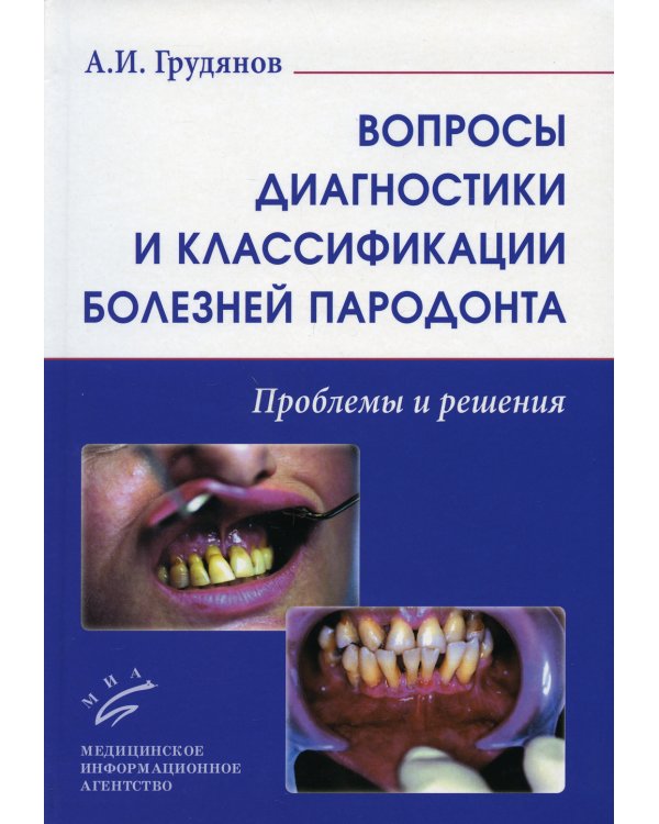 Вопросы диагностики и классификации болезней пародонта. Проблемы и решения