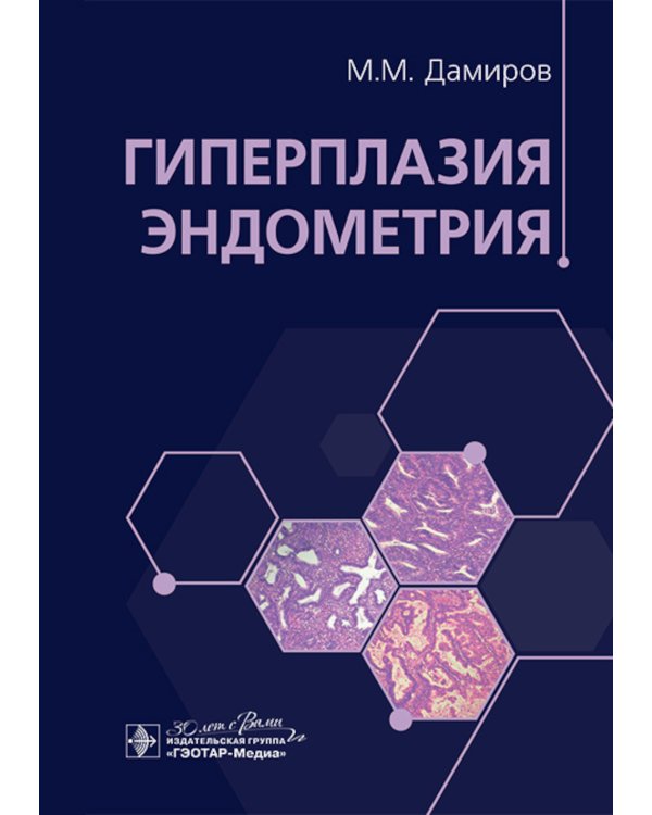 Гиперплазия эндометрия