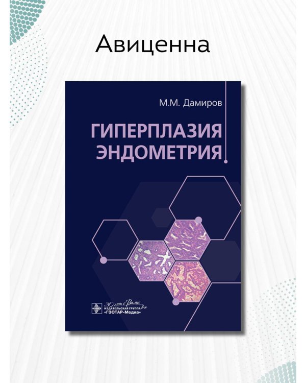 Гиперплазия эндометрия